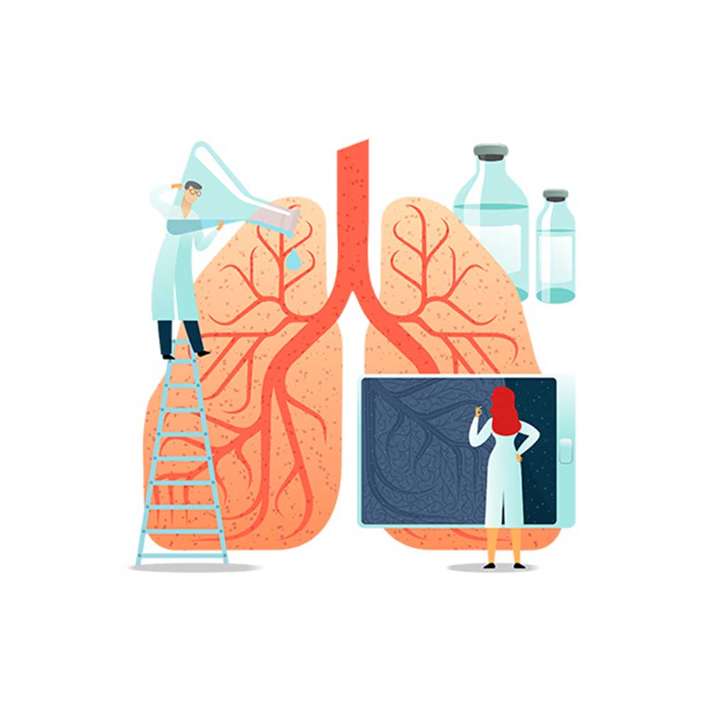 An All-Inclusive Guide to Lung Cancer Care